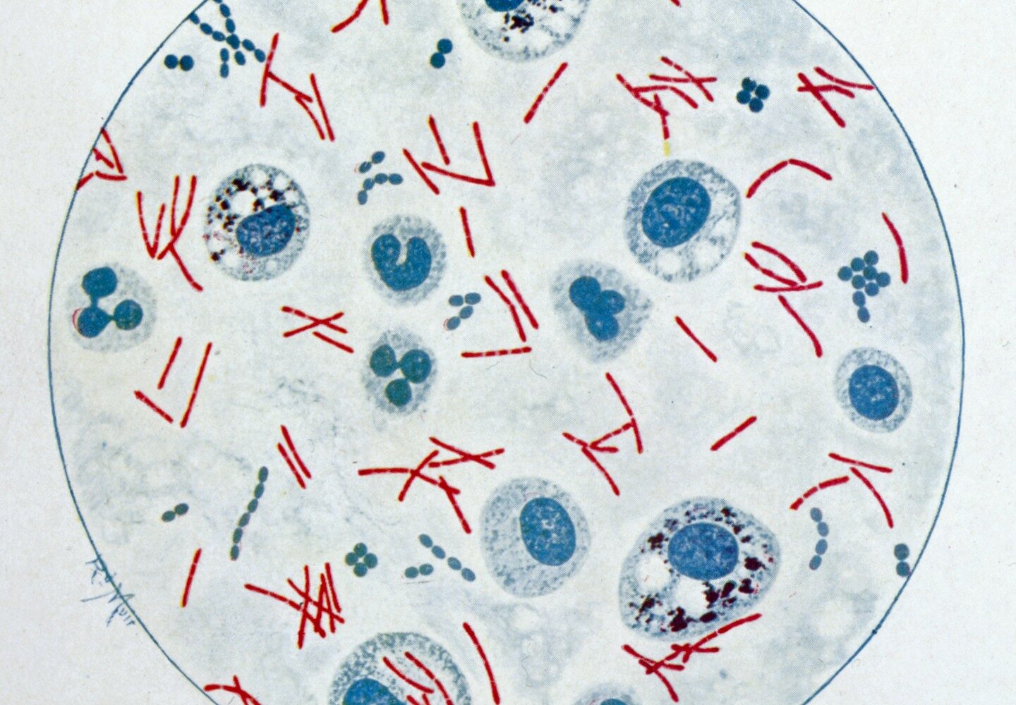 Z "Bakteriologického atlasu" R. Muira (1927)Bacteriological Atlas, 1927)