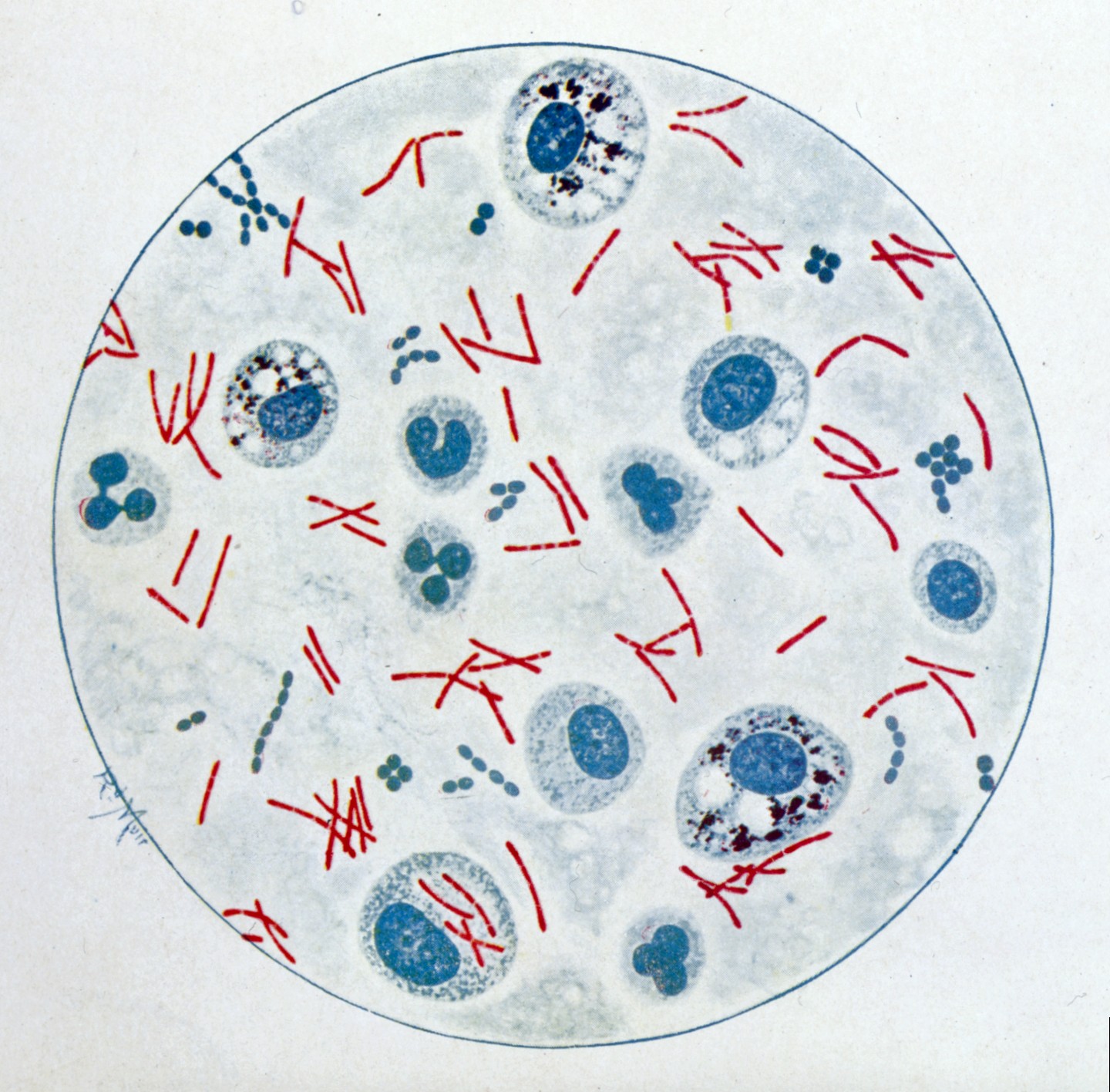 Z "Bakteriologického atlasu" R. Muira (1927)Bacteriological Atlas, 1927)