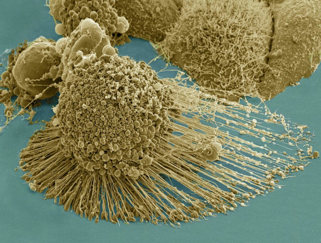 
Tento působivý snímek z elektronového mikroskopu zachycuje jednu buňku HeLa linie v poněkud atypické situaci – během tzv. apoptózy, tedy v podstatě řízené sebedestrukce. Hlavní devízou těchto buněk je to, že apoptózou neprochází, a mohou se tedy v laboratoři množit prakticky bez omezení a do nekonečně. Ale v biologii málokteré pravidlo platí absolutně. (foto NIH)